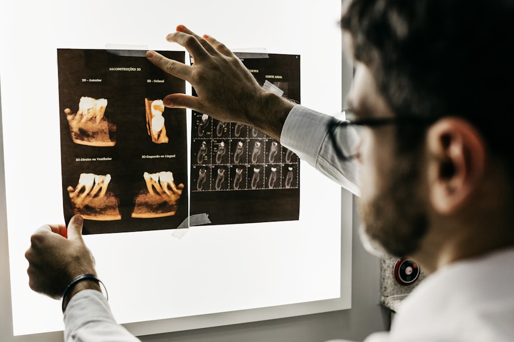 3D Digital Intraoral Scanning